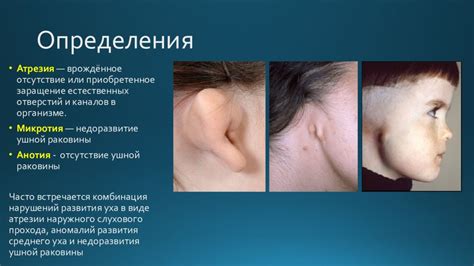 Операция по атрезии слухового прохода - восстановление слуха